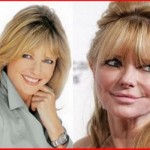 Cheryl Tiegs before and after picture 150x150