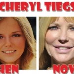 Cheryl Tiegs before and after plastic surgery 150x150