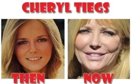 Cheryl Tiegs before and after plastic surgery