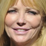 Cheryl Tiegs face with botox and facelift 150x150