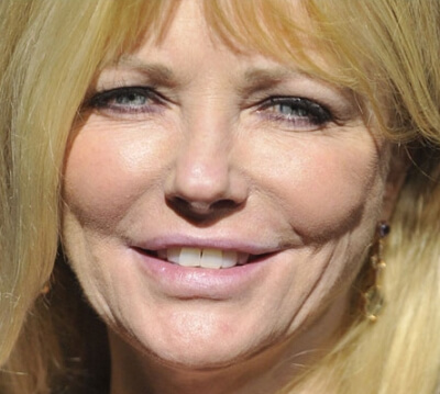Cheryl Tiegs face with botox and facelift