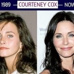 Courtney Cox before and after cosmetic procedures 150x150