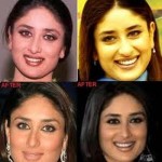 Kareena Kapoor before and after plastic surgery 150x150