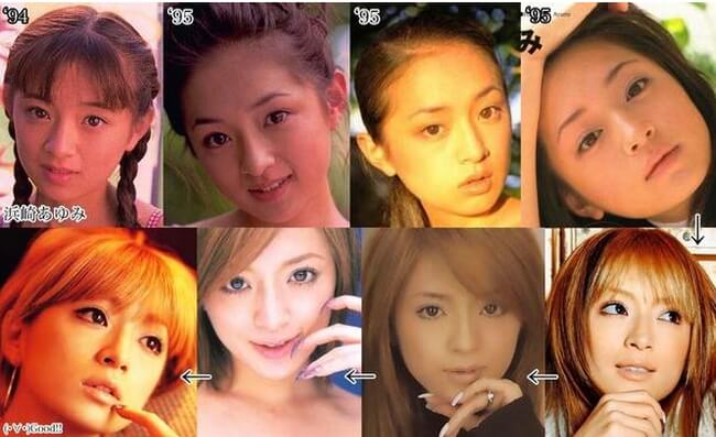 Ayumi Hamasaki plastic surgery before and after pictures
