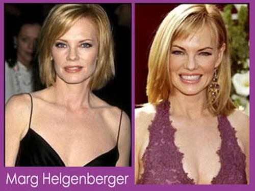 Marg Helgenberger before and after picture