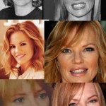 Marg Helgenberger before and after plastic surgery 150x150