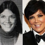 Kris Jenner before and after plastic surgeries 150x150