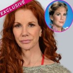 Melissa Gilbert before and after plastic surgery 150x150