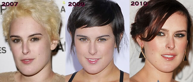 Rumer Willis before and after plastic surgery