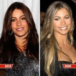 Sofia Vergara before and after 150x150
