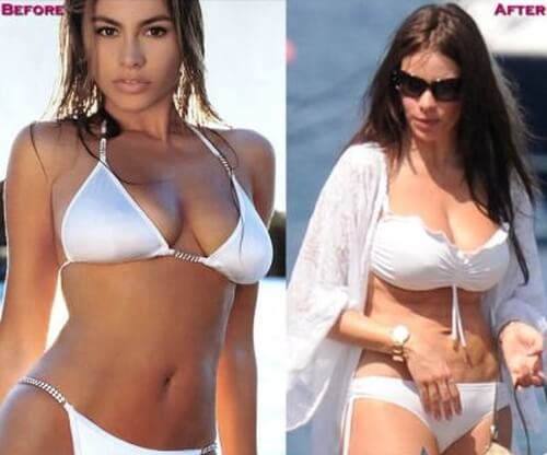 Sofia Vergara bofore and after pictures