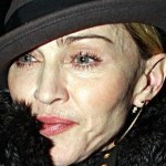 Madonna Botox 150x150