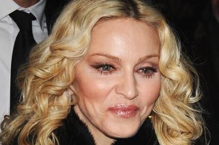 Madonna plastic surgery 2011
