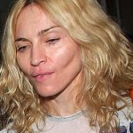 Madonna plastic surgery after 150x150