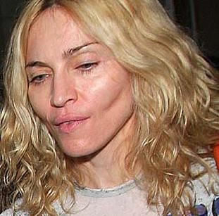 Madonna plastic surgery after