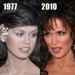 Marie Osmond before and after plastic surgeries 150x150