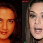 Preity Zinta before and after 150x150