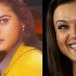 Preity Zinta before and after cosmetic procedures 150x150