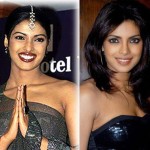Priyanka Chopra before and after plastic surgery 150x150