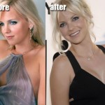 Anna Faris boob job before and after pictures 150x150