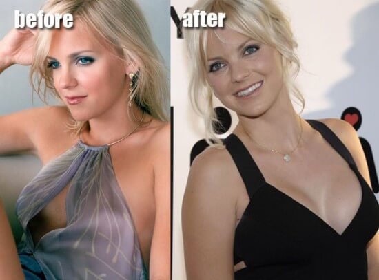Anna Faris boob job before and after pictures