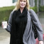 Melanie Griffith before and after plastic surgery  150x150