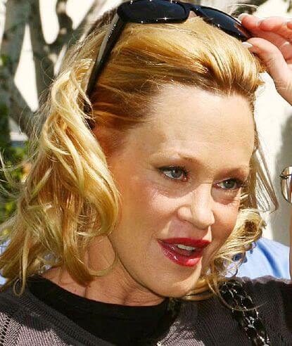 Melanie Griffith plastic surgery after