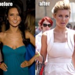 Audrina Patridge before and after photo 150x150