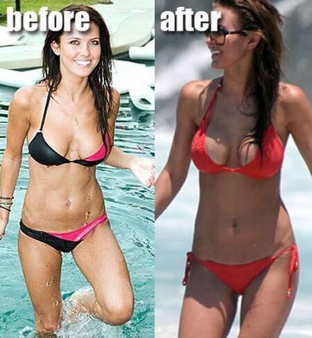 Audrina Patridge before and after photos