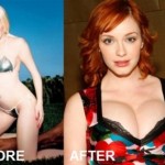 Christina Hendricks plastic surgery before and after 150x150