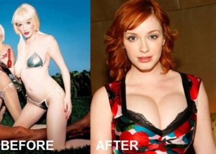 Christina Hendricks plastic surgery before and after