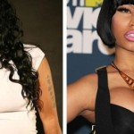 Nicki Minaj plastic surgery before and after photos 150x150