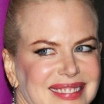 Nicole Kidman plastic surgery lips 150x150