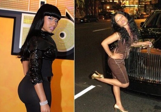 Picture of Nicki Minaj before plastic surgery
