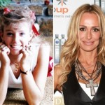 Taylor Armstrong before and after plastic surgery 150x150