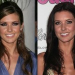 audrina patridge face after and before 150x150