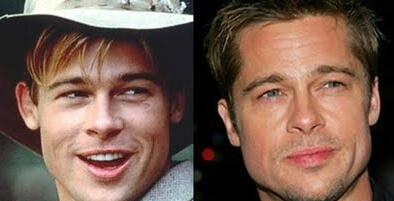 Brad Pitt plastic surgery before and after