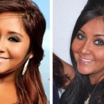 snooki before and after nose job 150x150