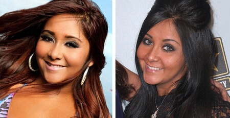 snooki before and after nose job