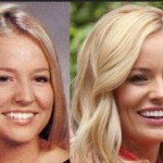 Emily Maynard before and after plastic surgery 150x150