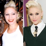Gwen Stefani plastic surgery before after 150x150