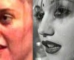 Gwen Stefani plastic surgery before and after 150x121