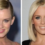 Jenny McCarthy plastic surgery before after 150x150