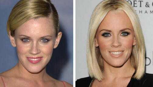 Jenny McCarthy plastic surgery before after