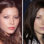 Jessica Biel plastic surgery before and after 150x150