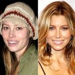 Jessica Biel surgery before and after 150x150