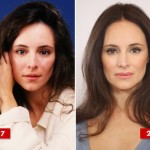 Madeleine Stowe before and after plastic surgery 150x150