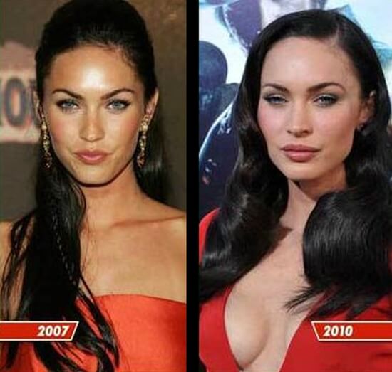 Megan before and after boob job