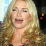 Shannon Tweed facelift 150x150