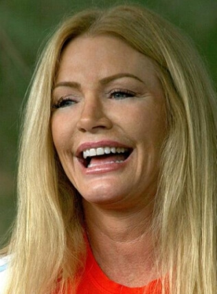 Shannon Tweed facelift photos